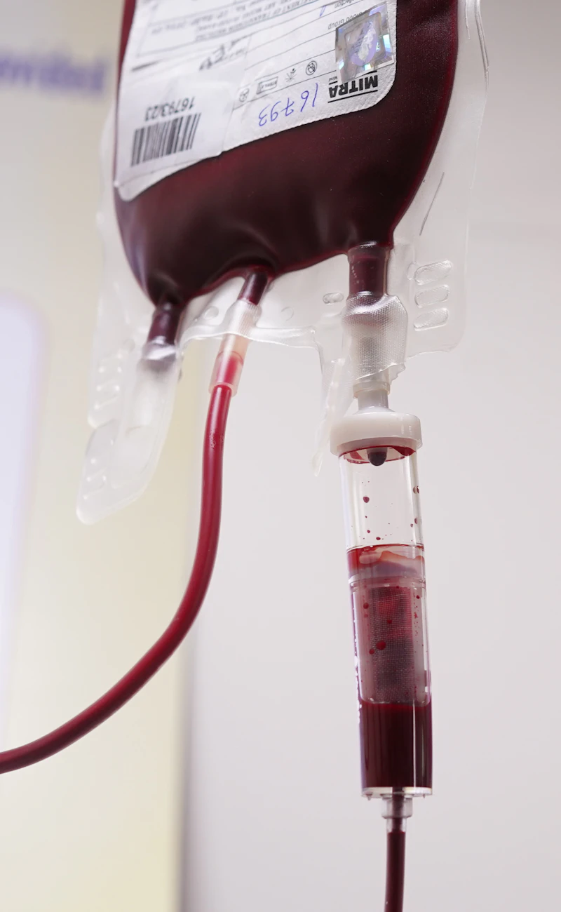 Bolsa de sangre para transfusión